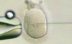 第一代、第二代和第三代试管婴儿有何区别?