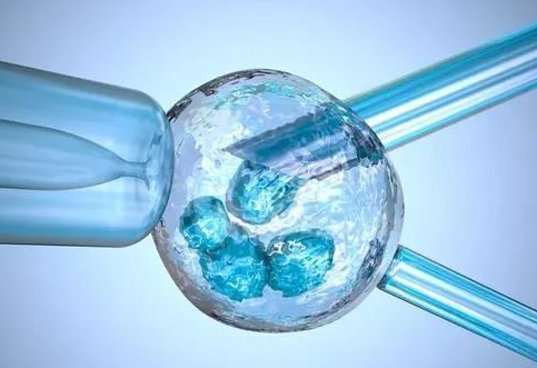 试管婴儿取卵全解析：方法、数量与注意事项